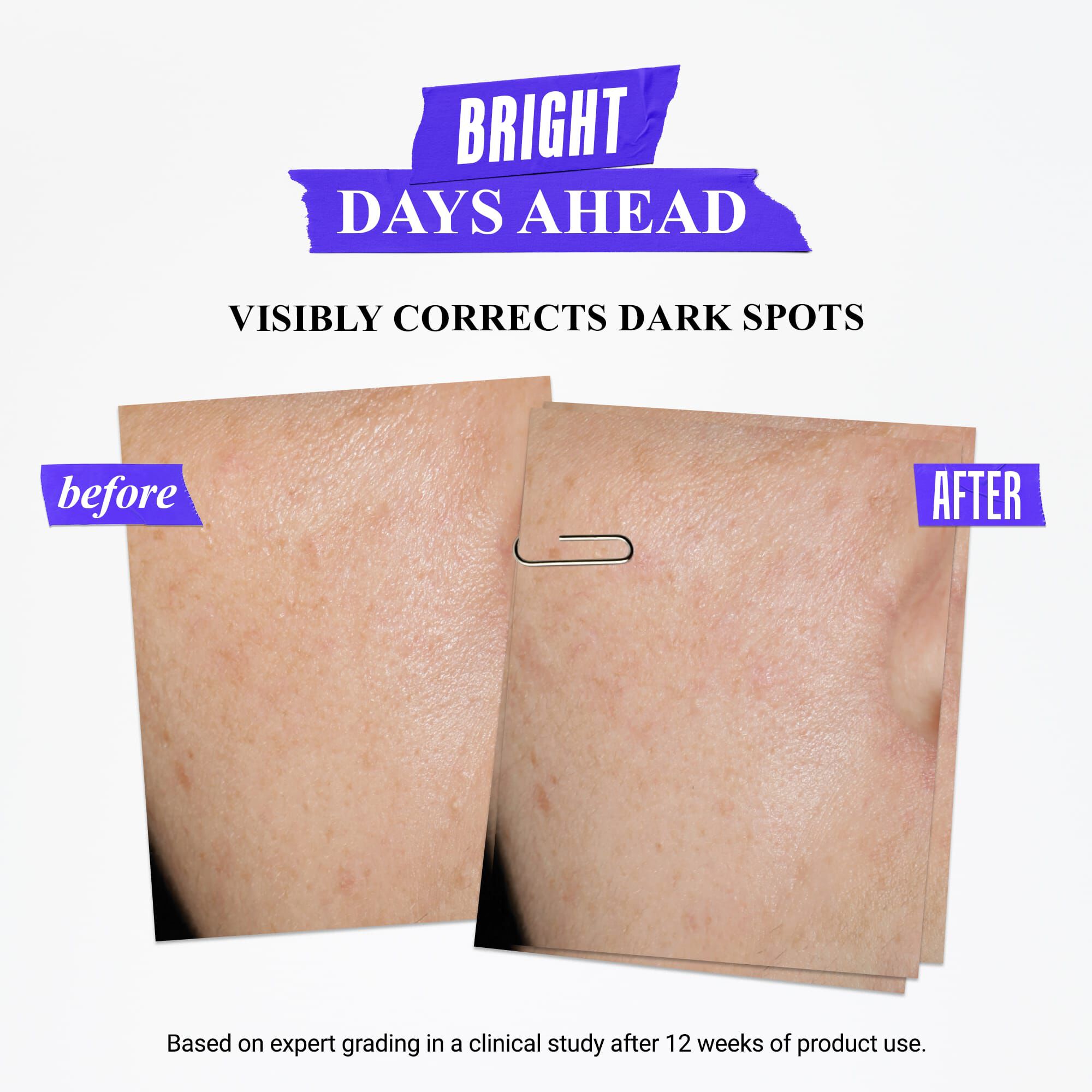 سيروم كليرلي كوريكتيف لتصحيح البقع الداكنة -automationTestProduct