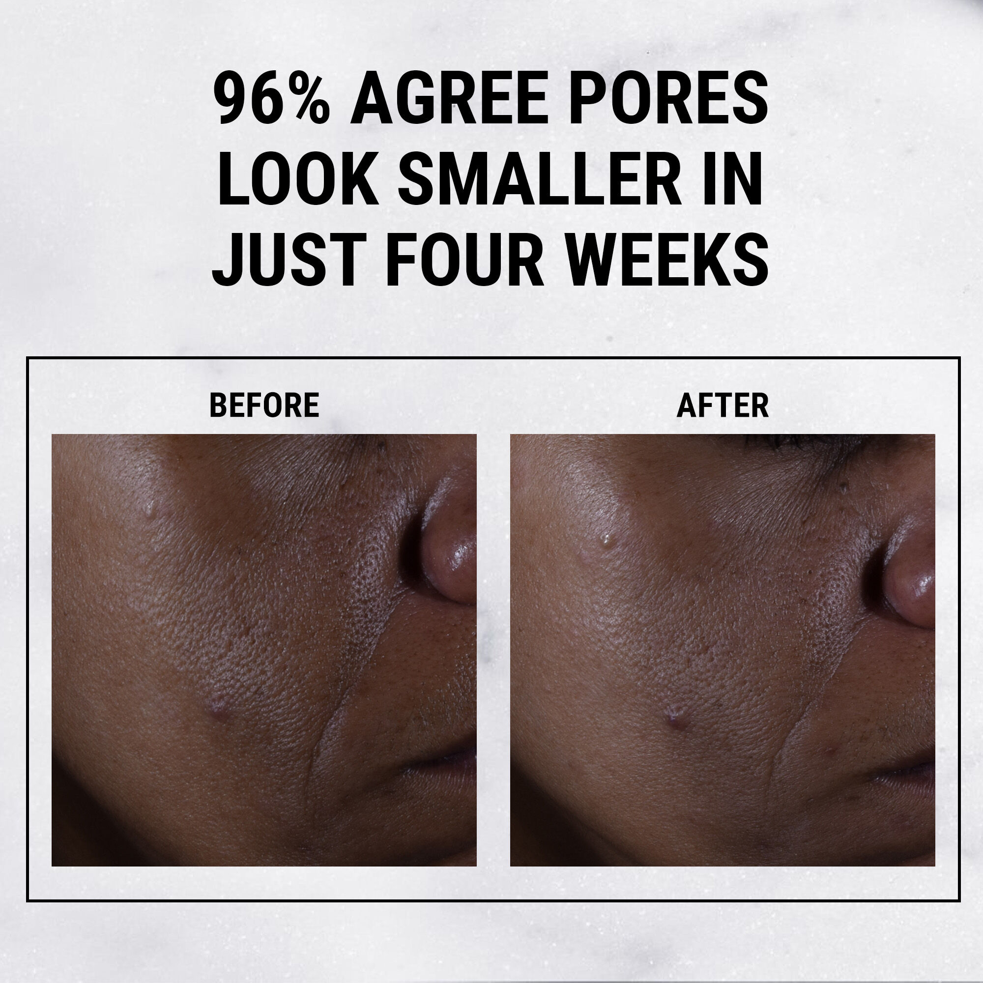 سيروم ألترا بيور هاي بوتينسي ٩.٨٪  حمض جليكوليك